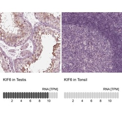 KIF6 Antibody, Novus Biologicals 25 &mu;L; Unlabeled:Antibodies, Polyclonal